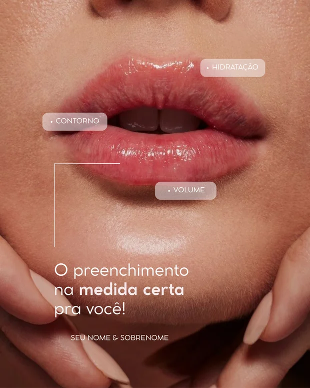 Arte do pack de HOF sobre preenchimento